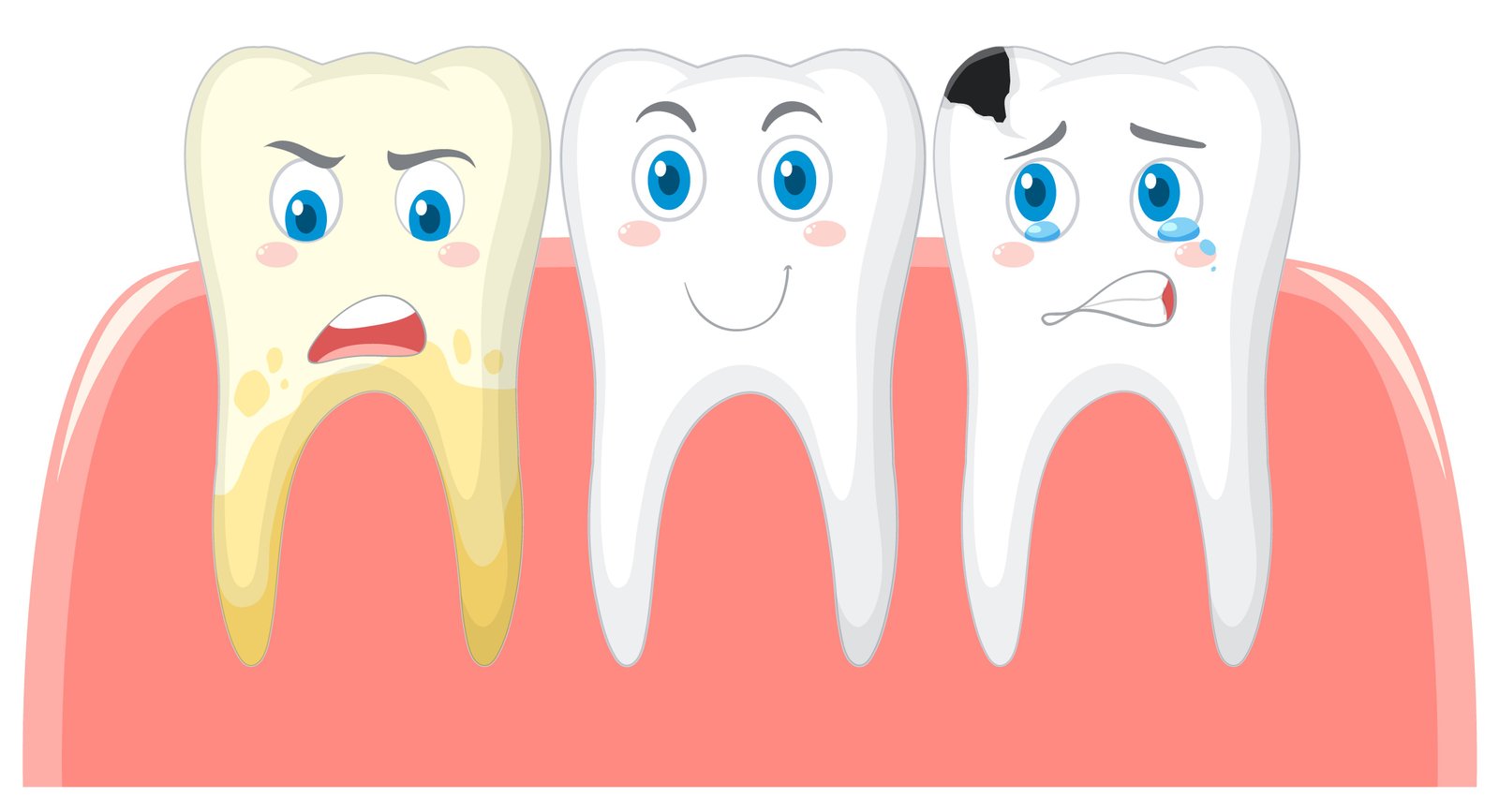 Dental Plaque and Decay Root Cause